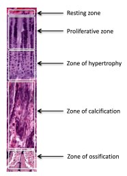 Composite Image Of Layers Of The Epiphyseal Plate General Histology